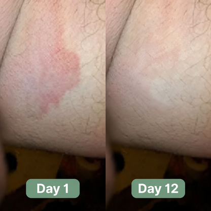 Vomeri™ Anti-fungal Soap