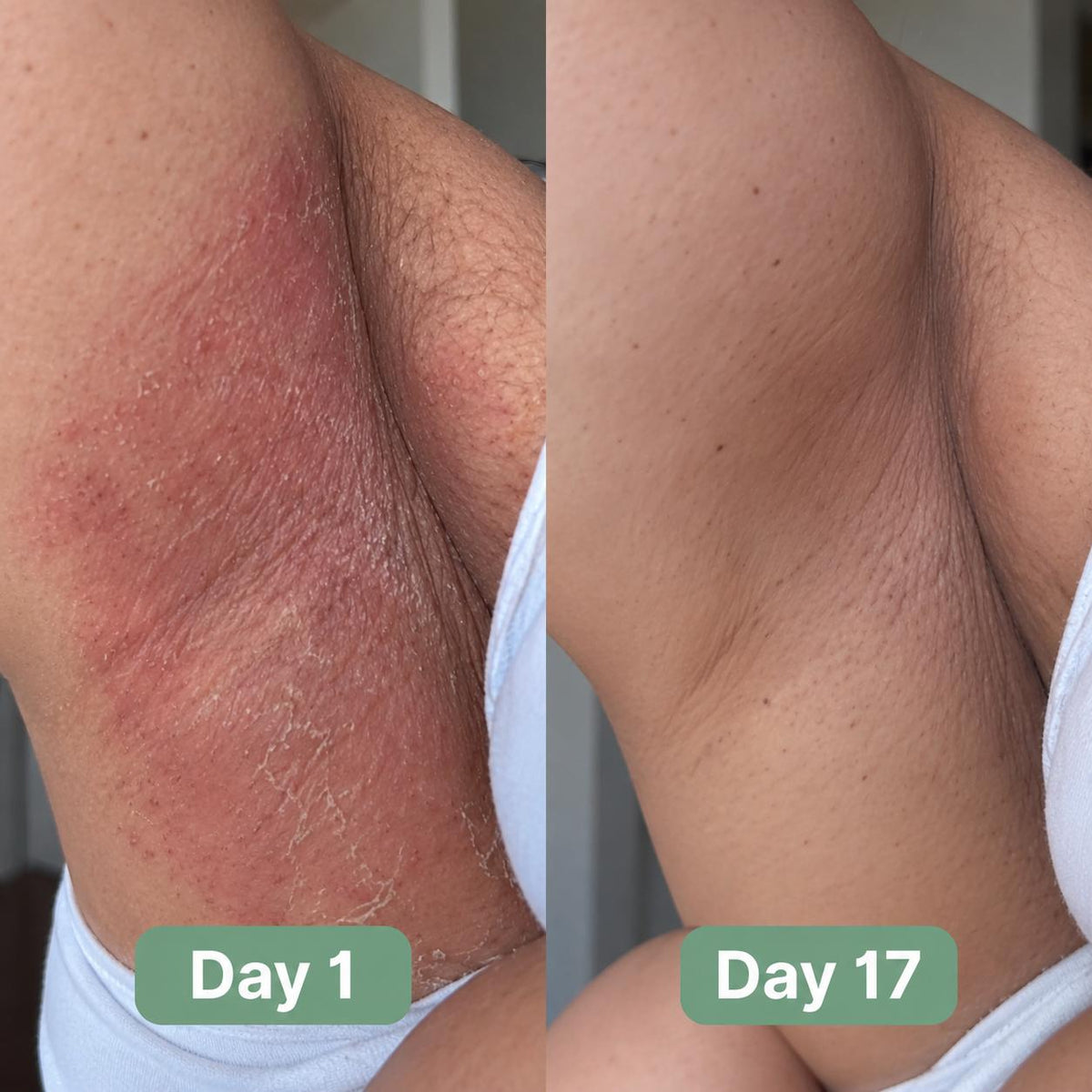 Vomeri™ Anti-fungal Soap